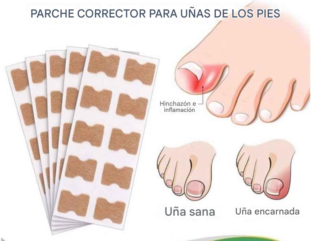 Pack(30) Parche Corrector de Uñas Encarnadas