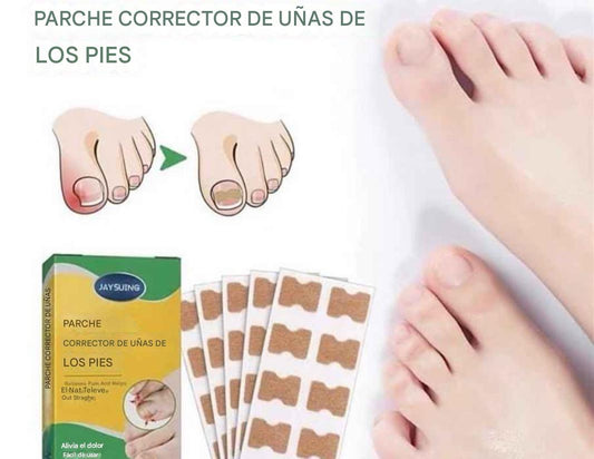 Pack(30) Parche Corrector de Uñas Encarnadas